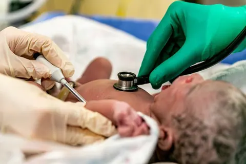 Applied forces with direct versus indirect laryngoscopy in neonatal intubation