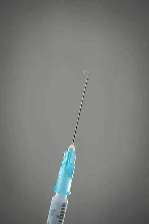 Dorsal penile nerve block versus caudal block for circumcision in pediatric patients