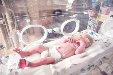 Evaluation of quality of care in neonatal anesthesia using a bundle of intraoperative parameters