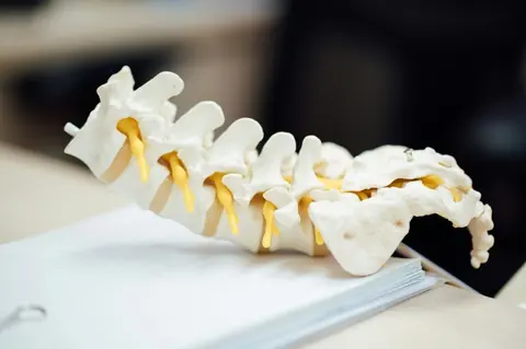 Second infant spinal anesthetic